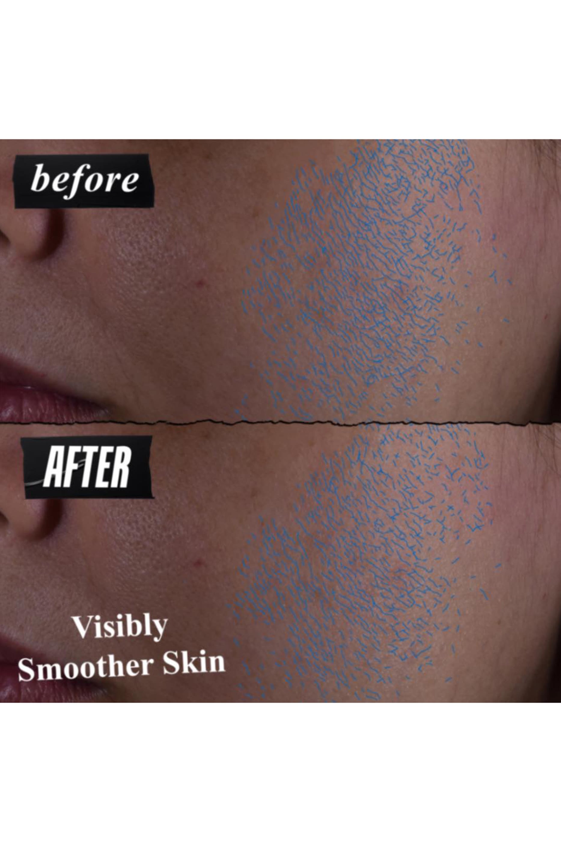 Clearly Corrective&trade; Daily Re-Texturizing Triple Acid Peel Serum