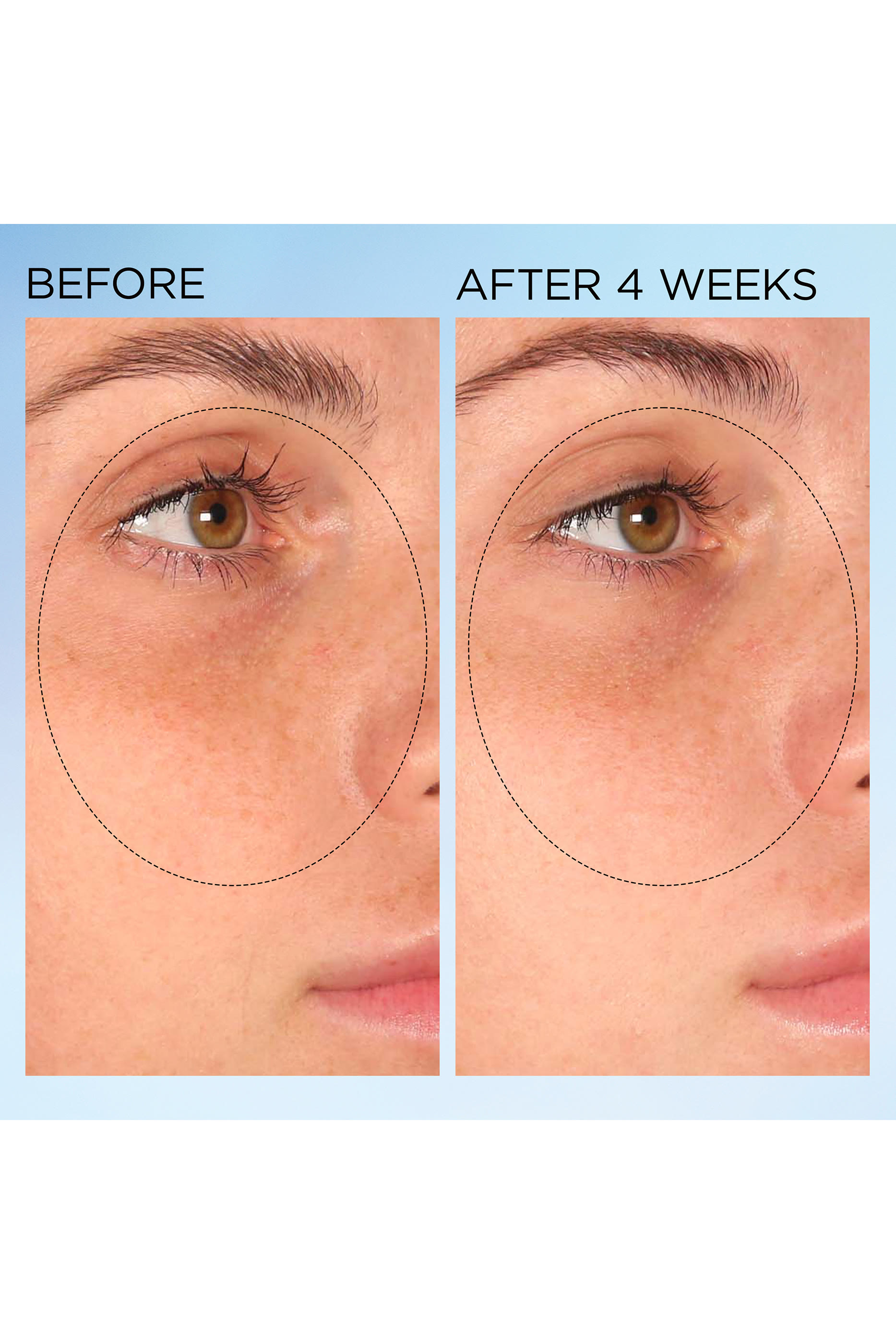  Visible Brightening Clearly Radiant Spot Correcting