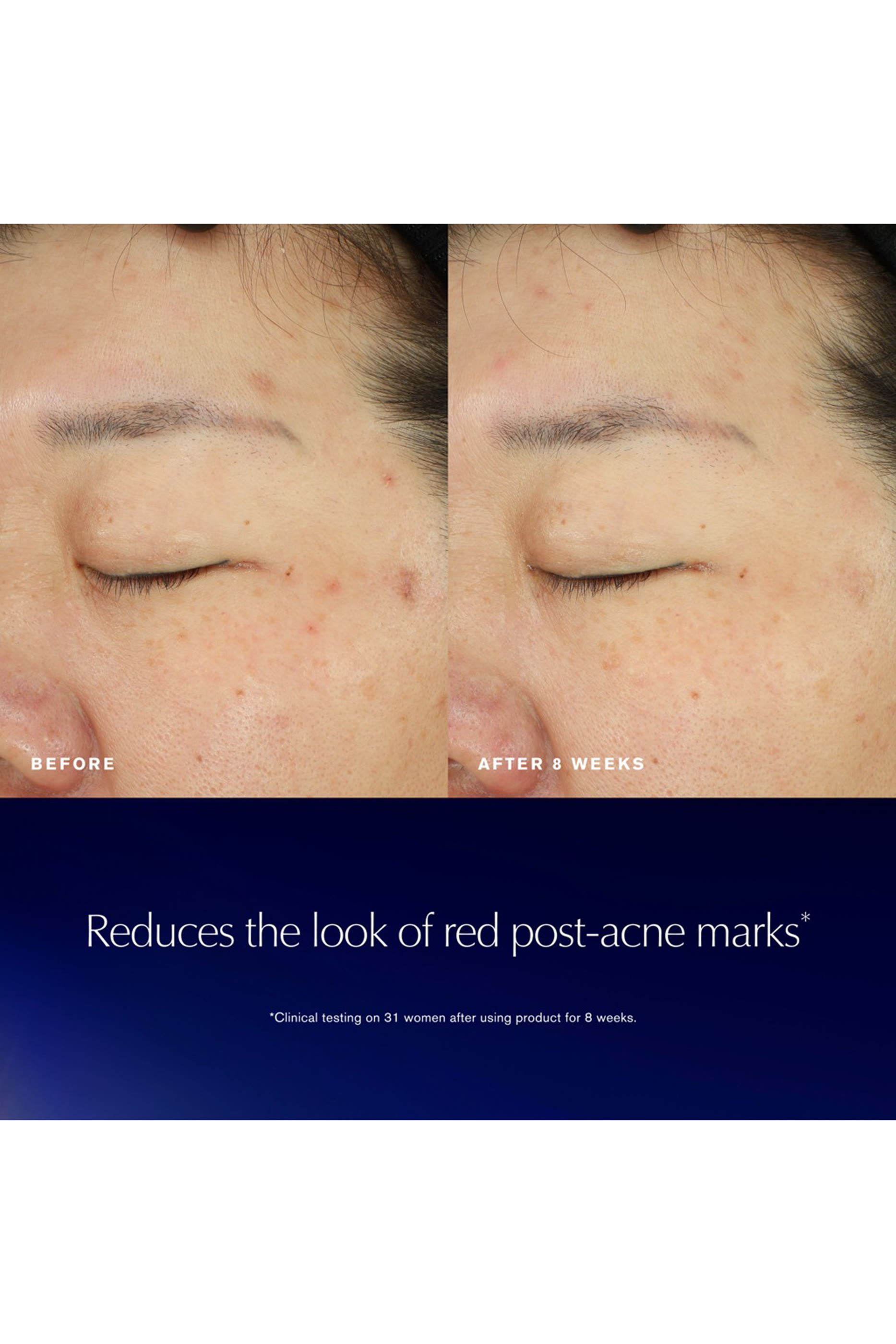 Advanced Night Repair Recovery Treatment Essence