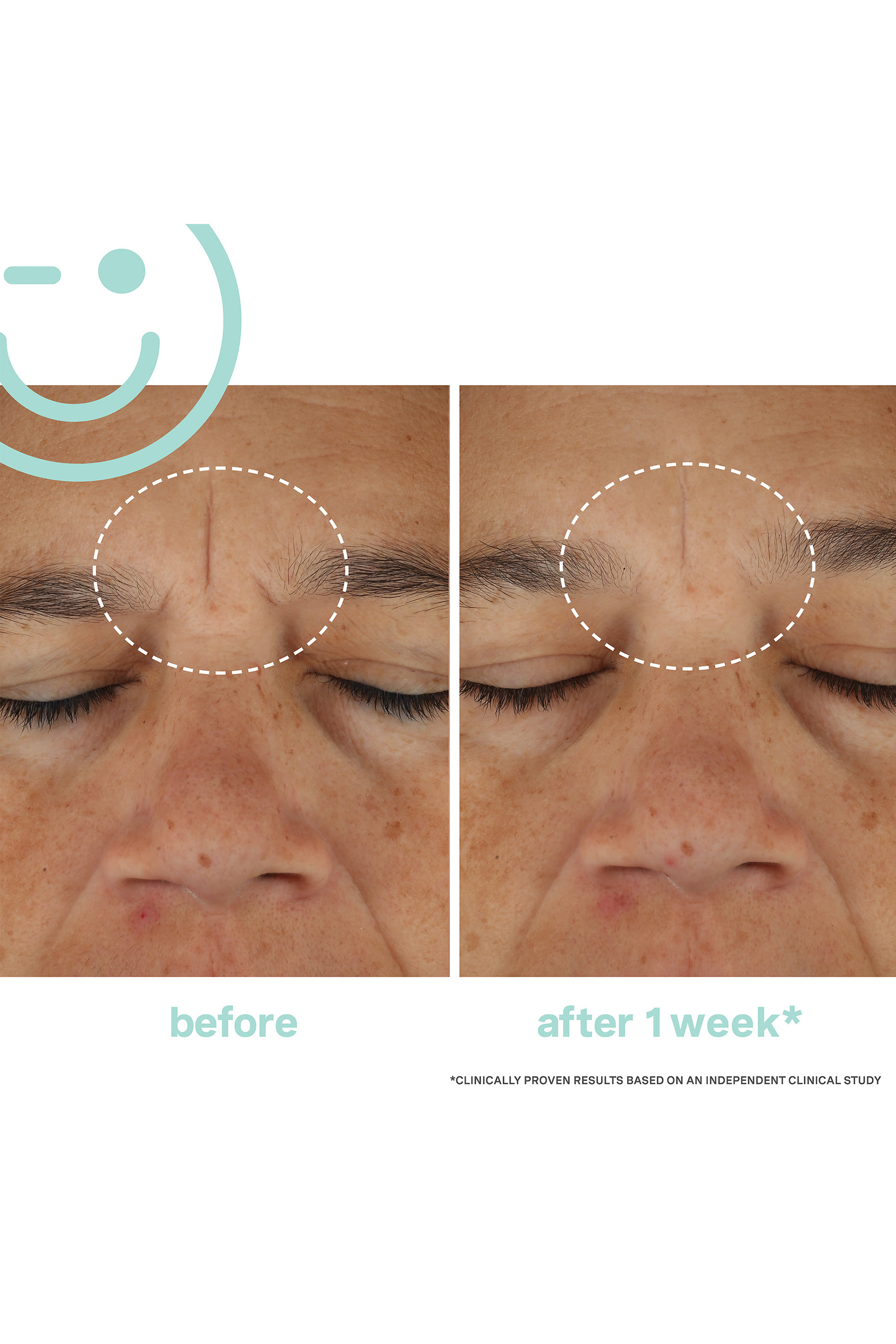 HydraKate™ Recharging Water Cream