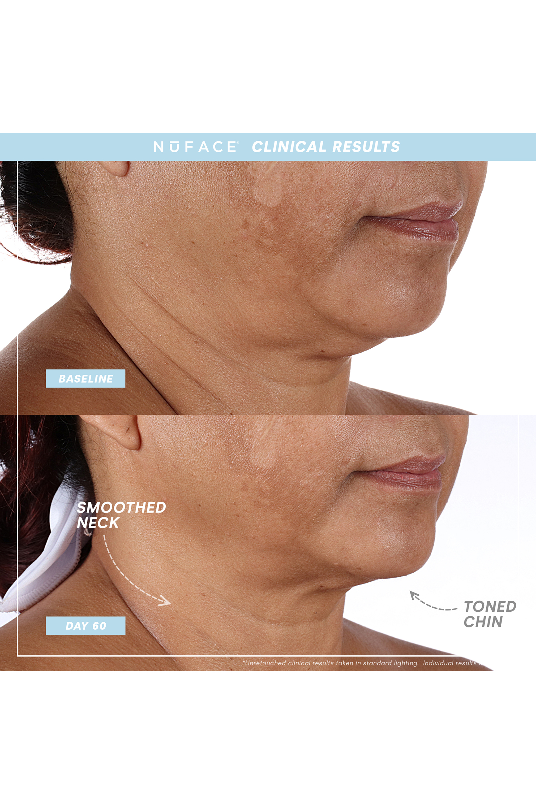 Trinity+ PRO Starter Kit