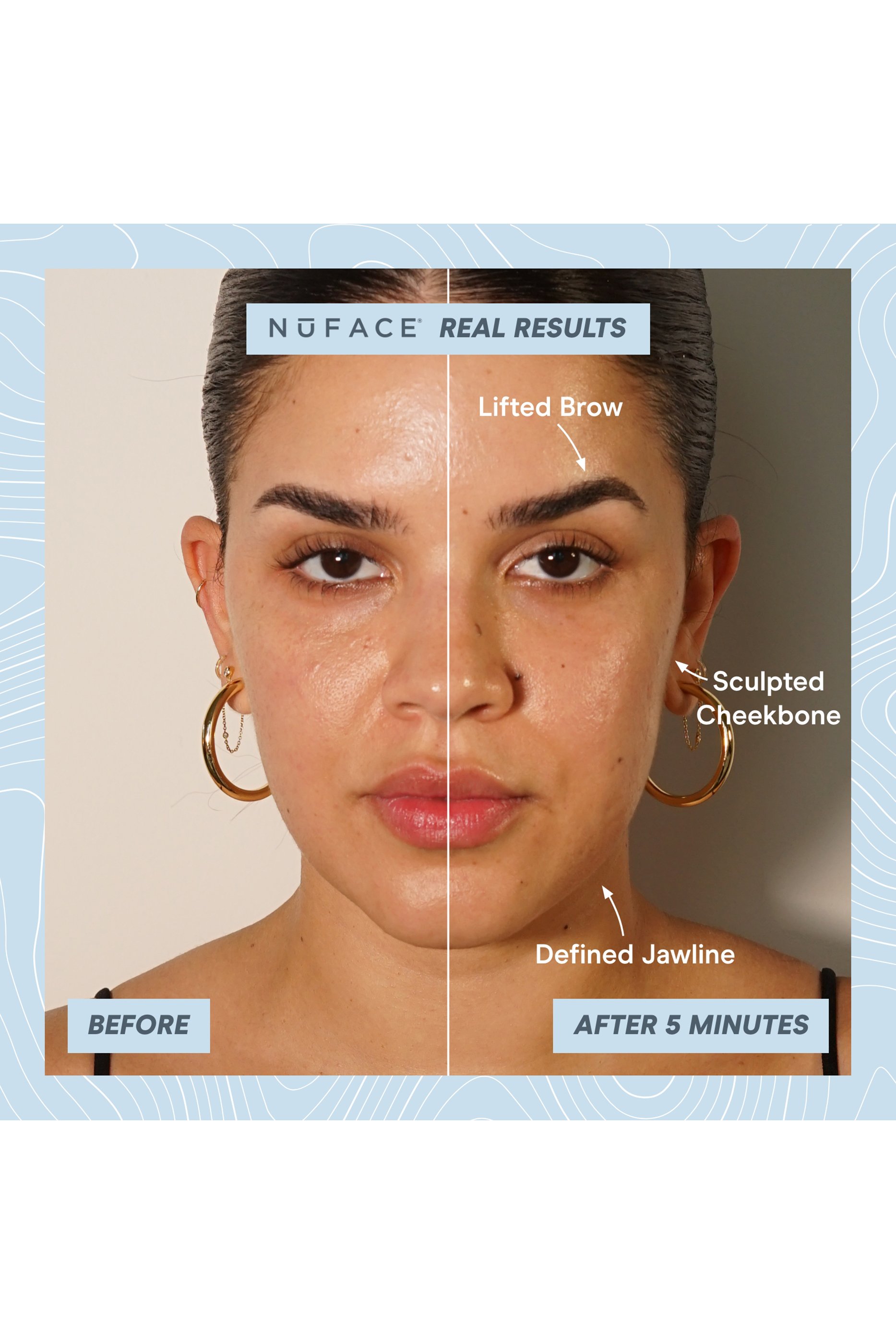 Trinity+ PRO Starter Kit